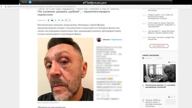 Синяк под глазом Посвящение в Иллюминаты Собчак, Лебедев, Шнуров, Папа Римский, Киселев